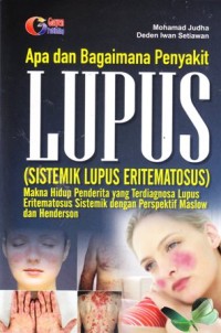 Image of Apa dan bagaimana penyakit lupus? (sistemik lupus eritematosus):makna hidup penderita yang terdiagnosa lupus eritematosus sistemik dengan perspektif maslow dan henderson