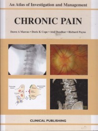 Image of Chronic Pain