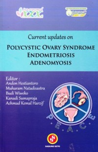 Image of Current updates on polycystic ovary syndrome endometriosis adenomyosis