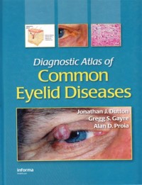 Image of Diagnostic atlas of common eyelid diseases