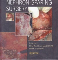 Image of Nephron - sparing surgeri