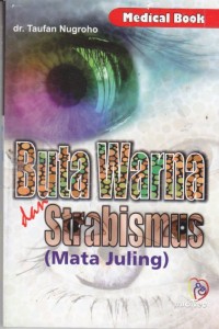 Image of Buta Warna dan Stabismus