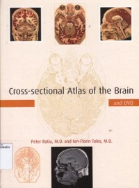 Image of Cross-sectional atlas of the brain