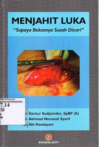 Image of Menjahit Luka. Supaya Bekasnya Susah Dicari