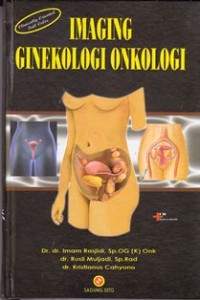 Image of Imaging ginekologi onkologi