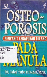 Image of Osteoporosis Penyakit Kerapuhan Tulang pada Manula